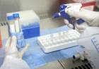 La OMS cambiará el nombre de las variantes de coronavirus para "no estigmatizar" a países