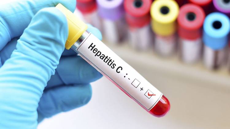 Afirman que "es el mejor momento" para curar la hepatitis C
